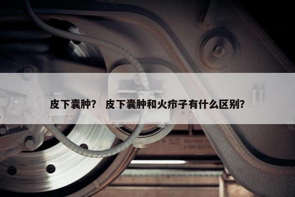 皮下囊肿？ 皮下囊肿和火疖子有什么区别？